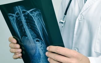 poradnia chirurgii klatki piersiowej