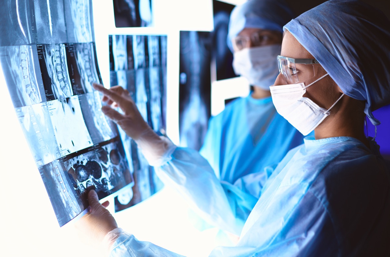 Doctors analyzing an x-ray in a meting