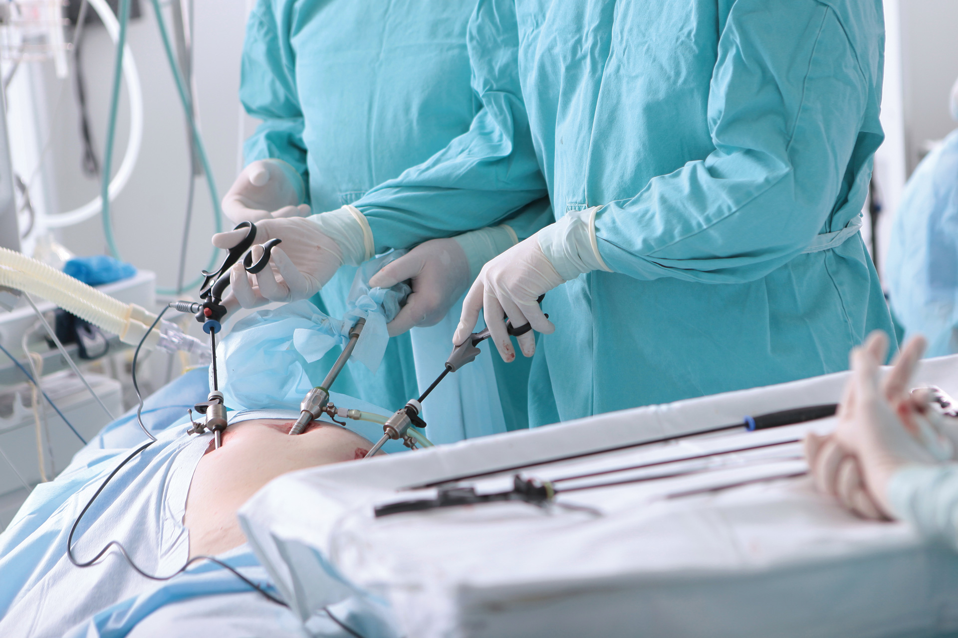 nowoczesna-operacja-laparoskopowa---AdobeStock_472701253